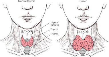 Thyroid surgery